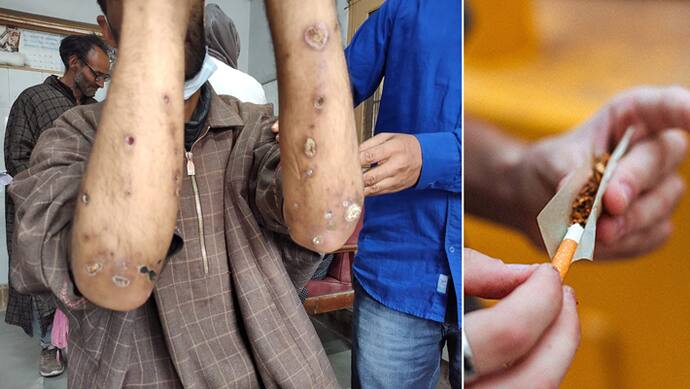 Drugs Epidemic in Kashmir