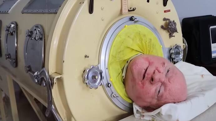 Polio survivor Paul Alexander has been confined to an iron lung for 70 years 