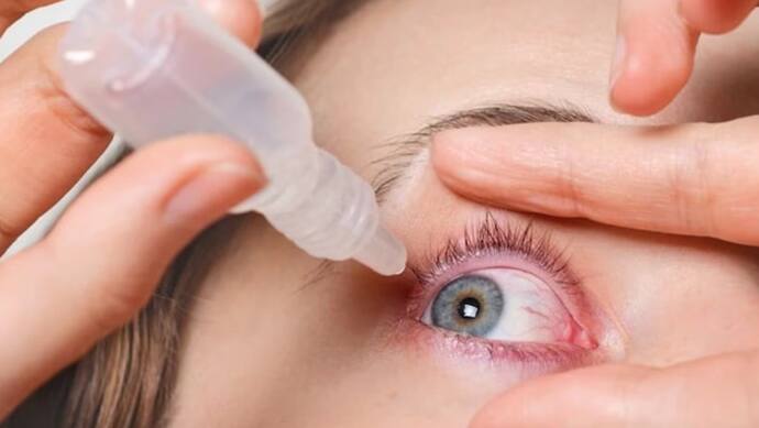 Eye Flu 5 Types and Treatment