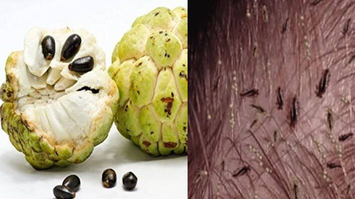 ow-to-get-rid-of-Lice-by-custard-apple-seed