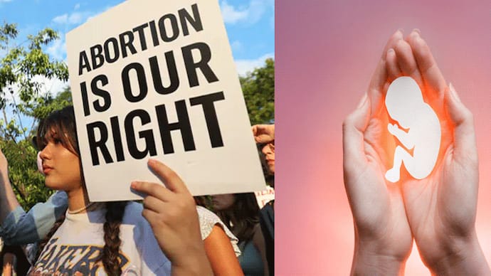abortion right in france