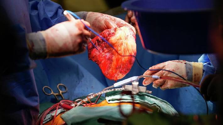 Heart Kidney Lungs Transfer Two doctors arrested