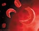 World Sickle Cell Anaemia Awareness Day: भारत में सिकल सेल एनीमिया के 1.40 लाख मरीज मिले, 3.37 करोड़ लोगों की हुई जांच