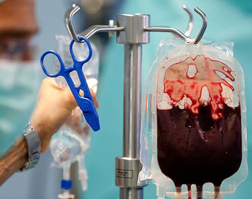 Blood transfusion